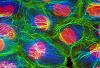EDS- notes-epithelial_cell.jpg